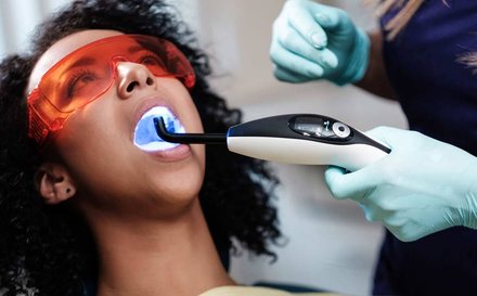 Teeth whitening at Cosmo Dental